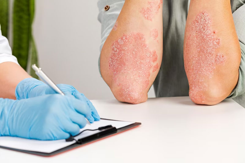 Dream about Canker interpretation