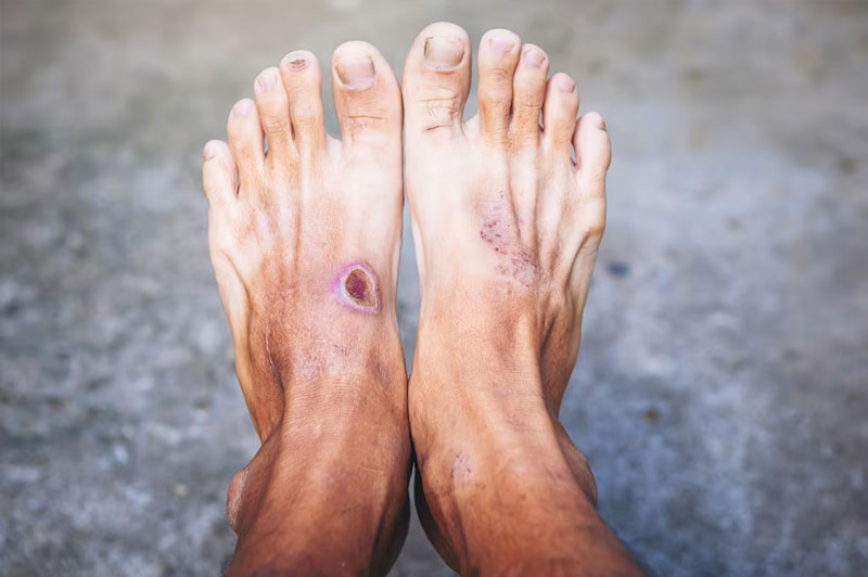 Dream about Gangrene interpretation