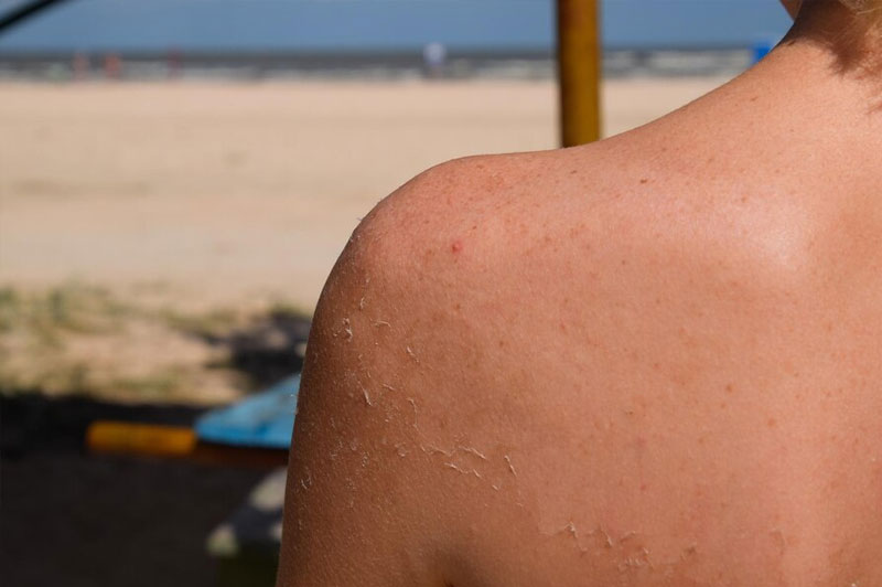 Dream about Leprosy interpretation