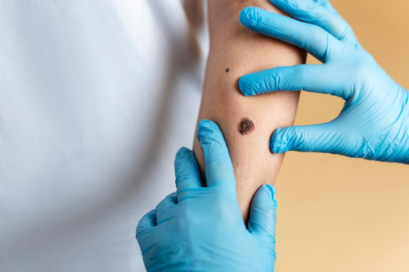 Dream about Mole interpretation