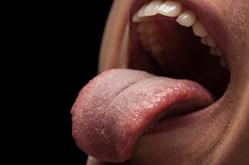 Dream about Tongue interpretation