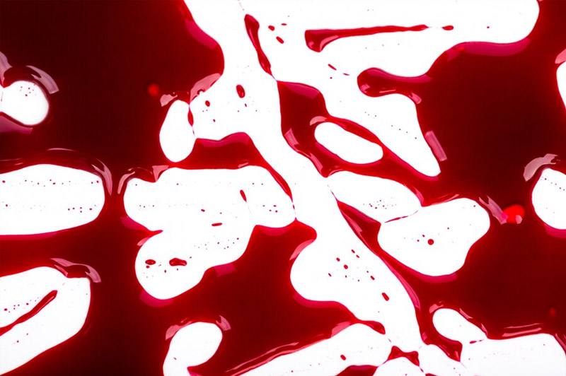 Dream about Blood, Pus etc. without any Wound interpretation