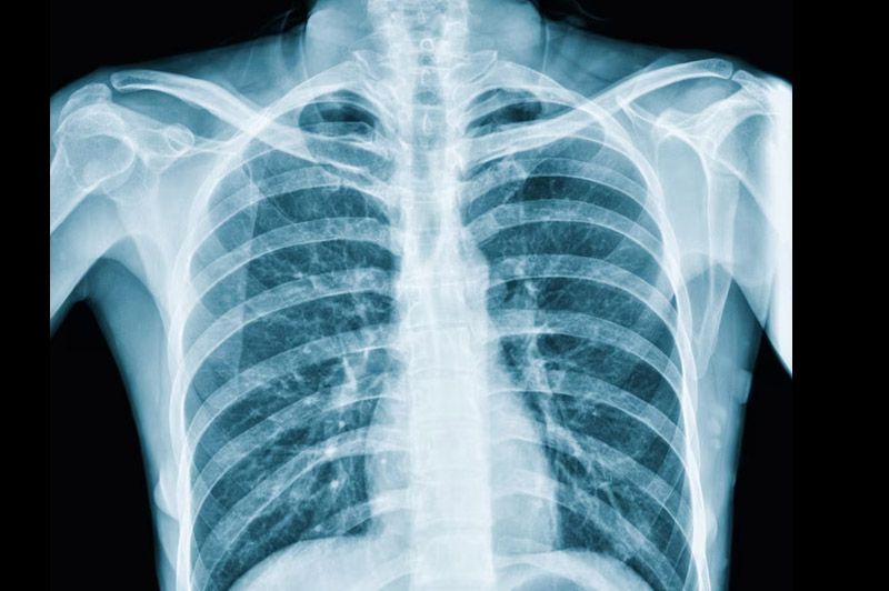 Dream about Ribs interpretation